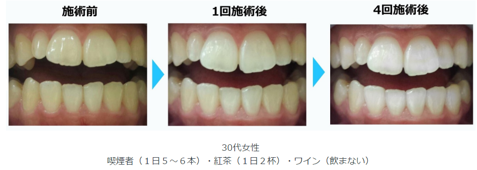 ビフォーアフターの一例